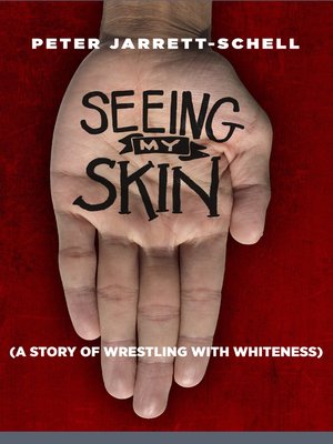 cover image of Seeing My Skin
